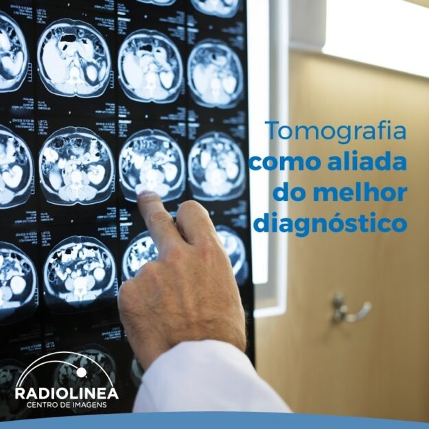 Diabetes: 14 de Novembro dia mundial de prevenção e controle